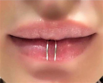 DELİKSİZ SIKIŞTIRMA FAKE DUDAK BURUN KULAK KIKIRDAK SEPTUM 316L C