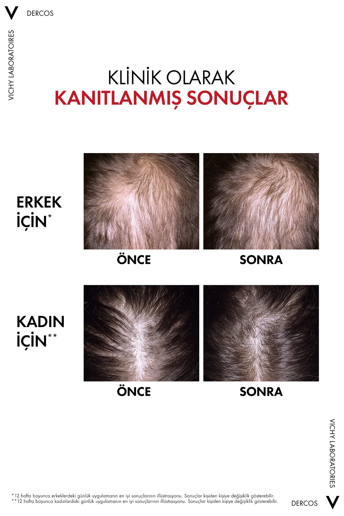 Dercos R.E.G.E.N. Booster Yenilikçi Saç Dökülmesine Karşı Bakım S