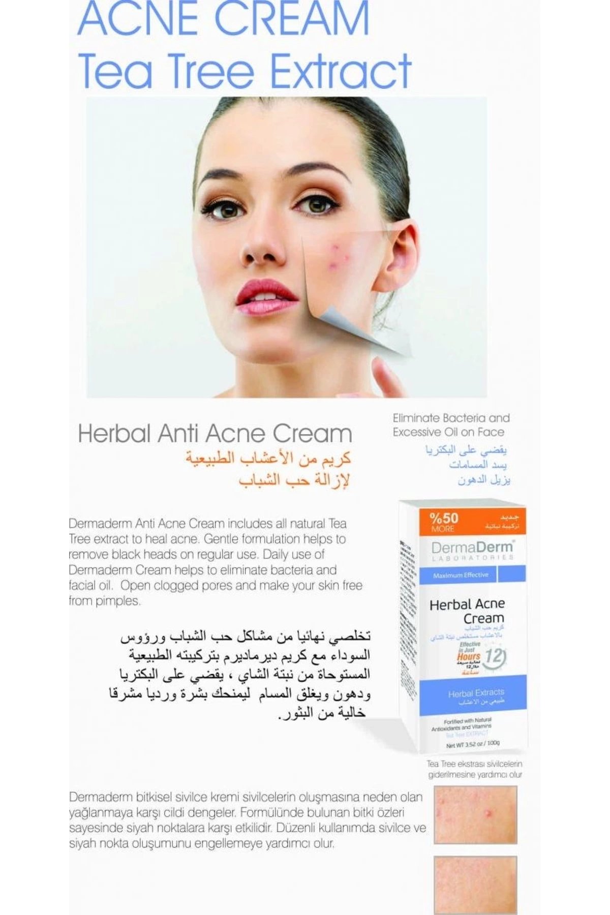 Dermaderm Bitkisel Sivilce Kremi 100g