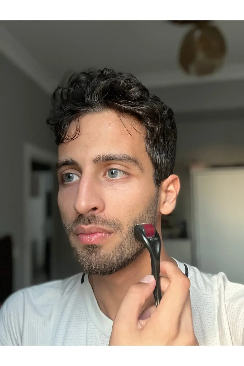 Dermaroller Titanyum 540 Iğneli 1 Mm Ve Ya 0.5 Mm