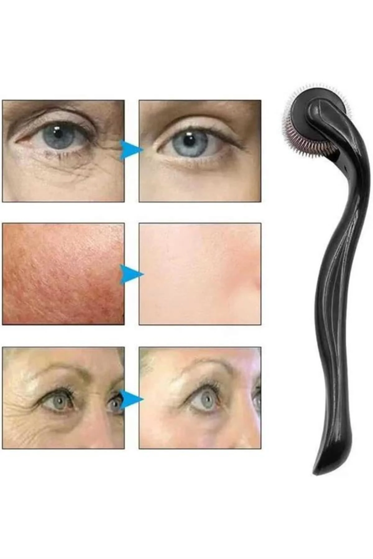 Dermaroller Titanyum 540 Iğneli 1 Mm Saç Kaş Sakal Serum Kullanım