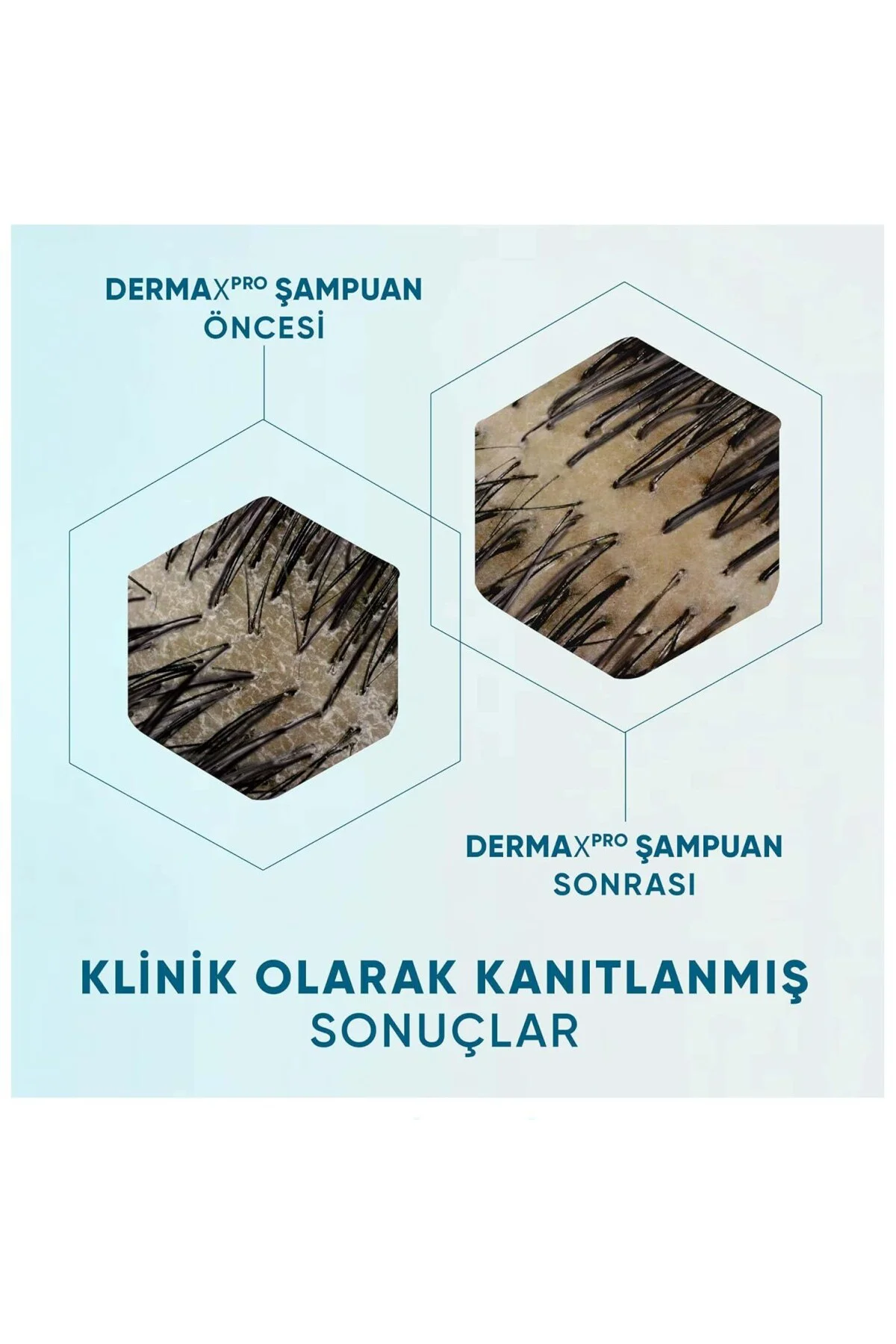 DermaXPro Yatıştırıcı Kepek Karşıtı Şampuan Kuru ve Kaşıntılı Saç Derisi iç DermaXPro Yatıştırıcı Kepek Karşıtı Şampuan Kuru ve Kaşıntılı Saç Derisi iç