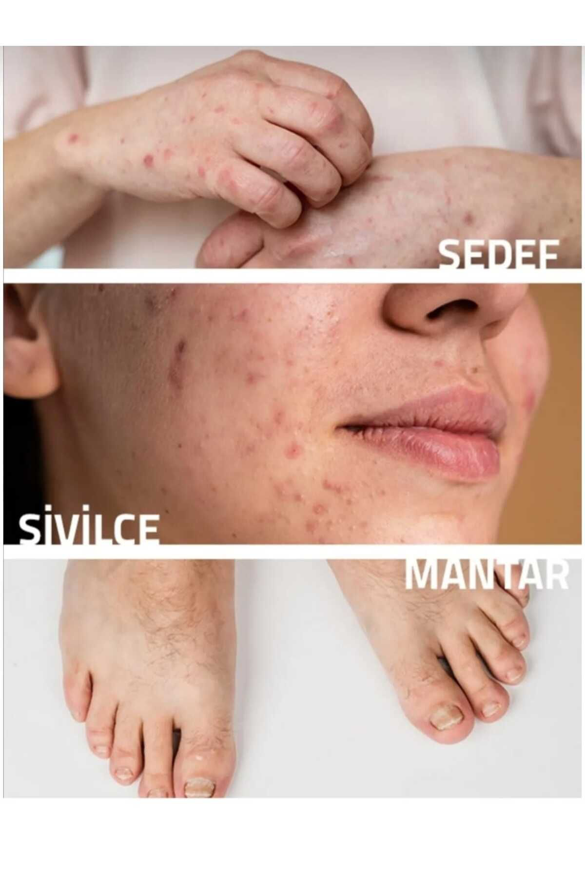 Rose La Belles Doğal Çörek Otlu Sabun Kabak Lifli 130Gr