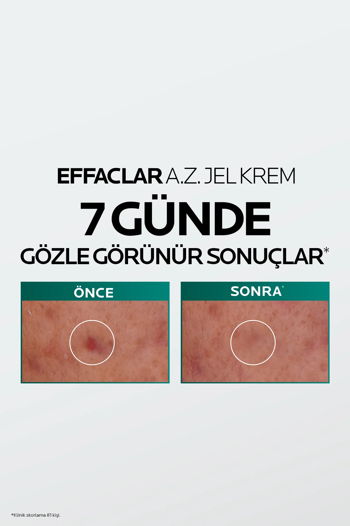 Effaclar A.Z. Gel Krem 40 ml - Görsel 4
