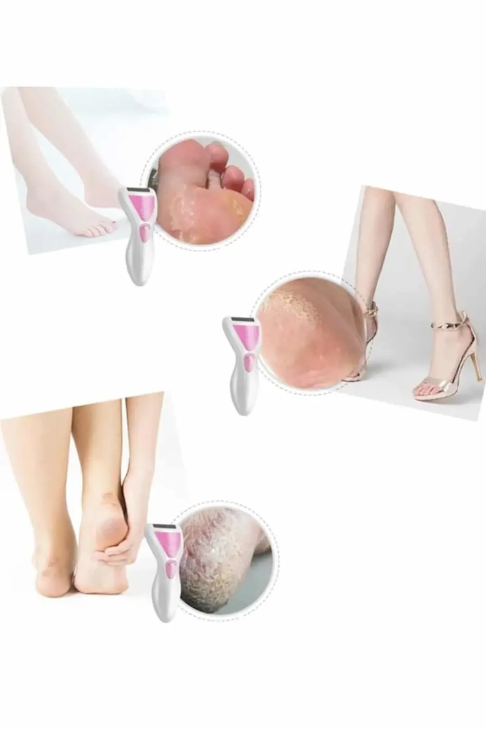 Epilatör Cihazı Epilasyon Aleti Çoklu Başlık Seçeneği Ayak Törpüs