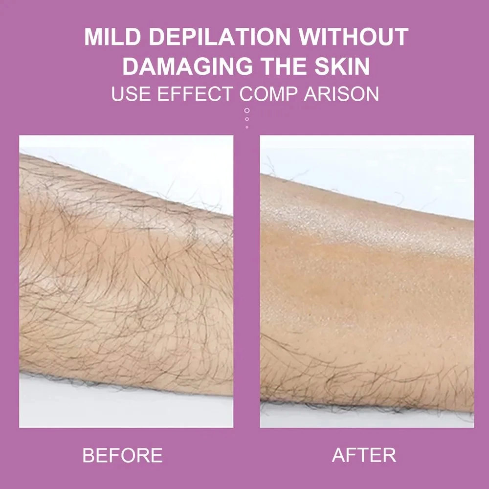 Epilatör Kristal Epilasyon Aleti Epilatör Kristal Epilasyon Aleti