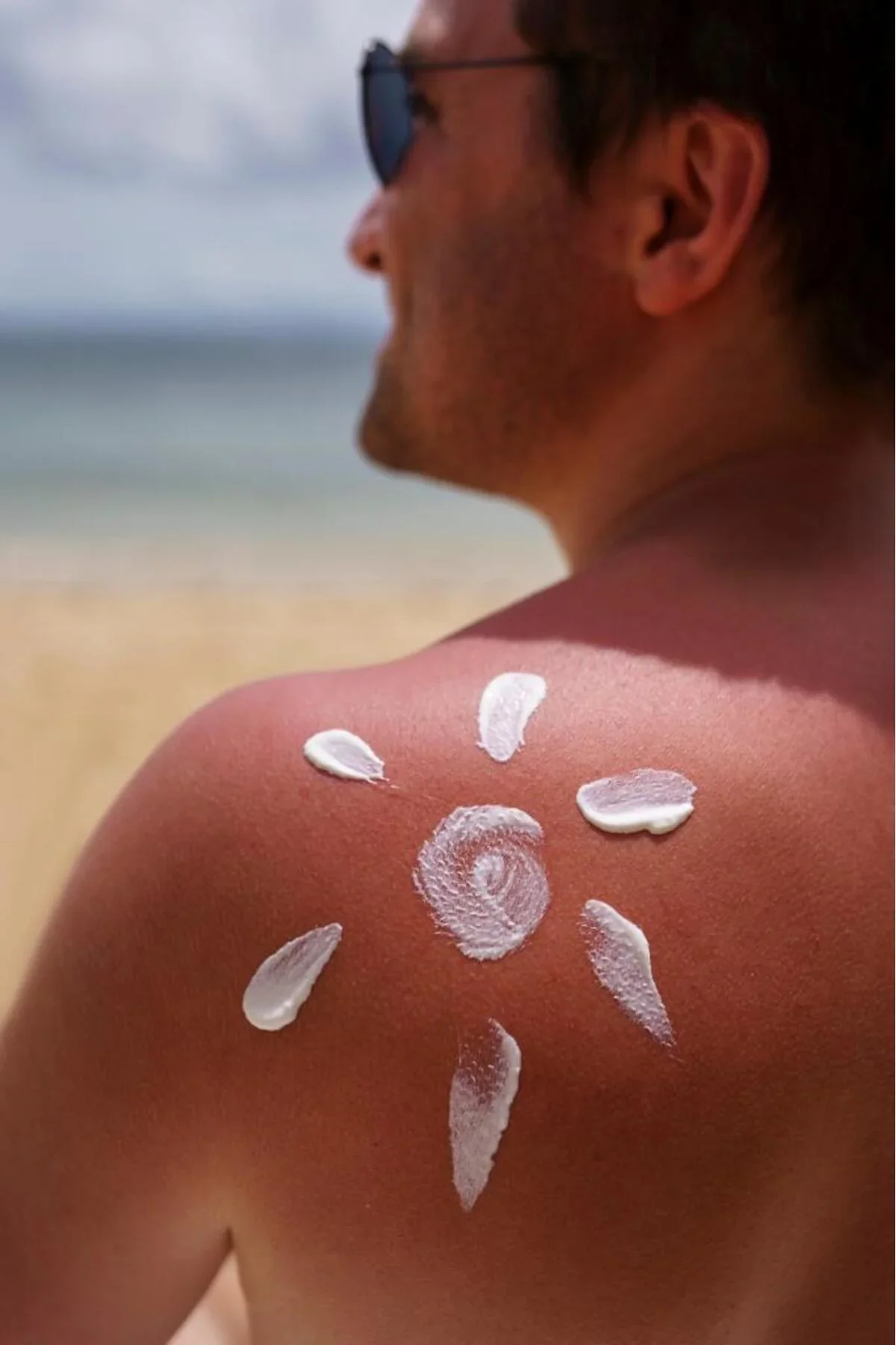 Equtone Leke Karşıtı Güneş Koruyucu Yeni Nesil Filtreli SPF50+ Krem 50 ml - Görsel 3