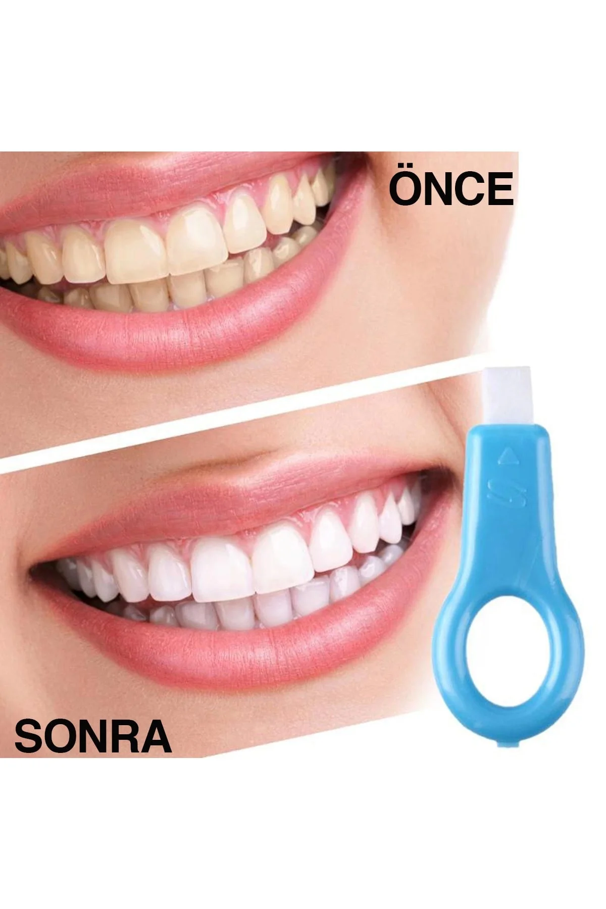 Etkili Ağız Bakımı Jel Diş Beyazlatıcı ( Lisinya )