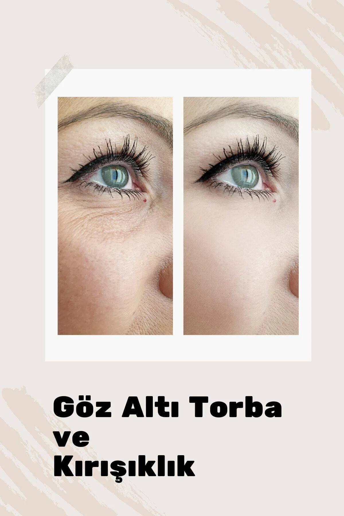 Göz Çevresi Canlandırıcı (GÖZALTI MORLUĞU, TORBALANMA, ŞİŞLİK) Gö