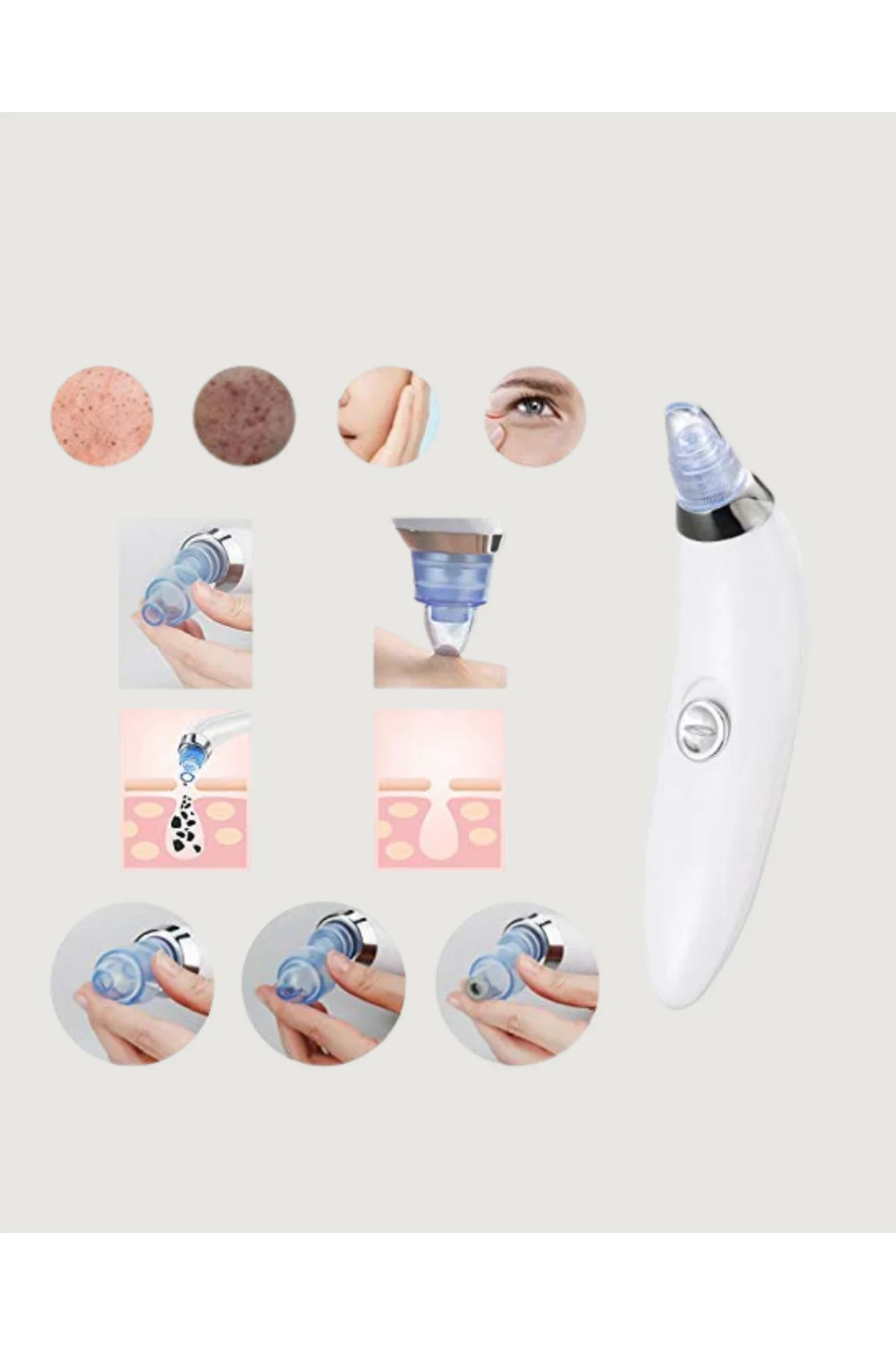 Güçlü Vakumlu Siyah Nokta Temizleyici – Cilt Pürüzlerini Gideren 