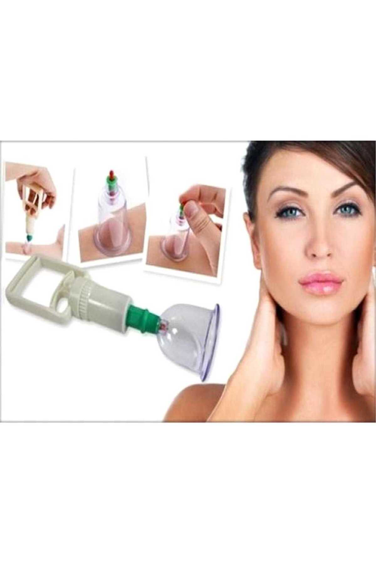 Hacamat Seti - Vakumlu Kupa Çekme Seti (MODEL 2)