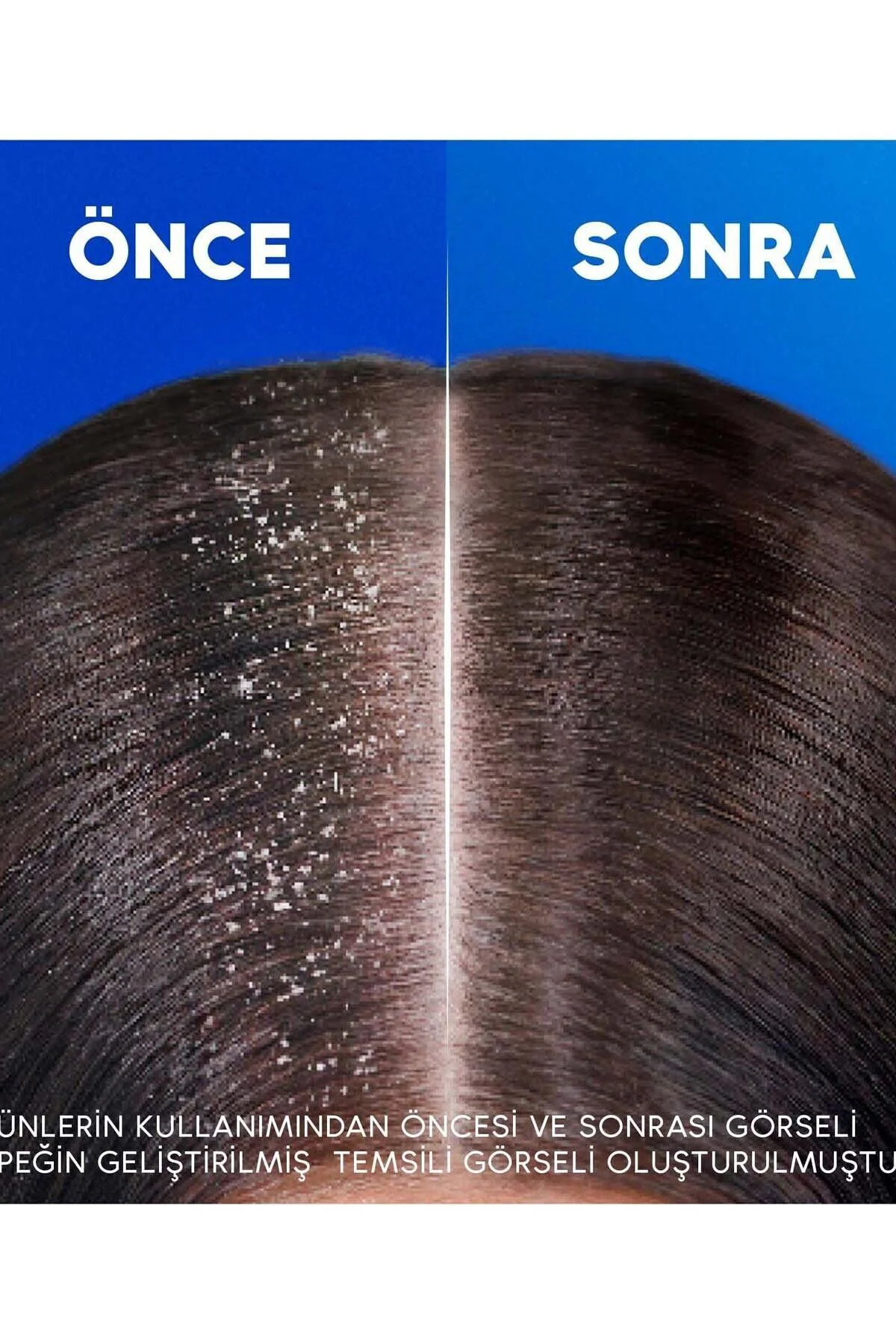Head & Shoulders Derinlemesine Nemlendirici Hindistan Cevizi Yağı