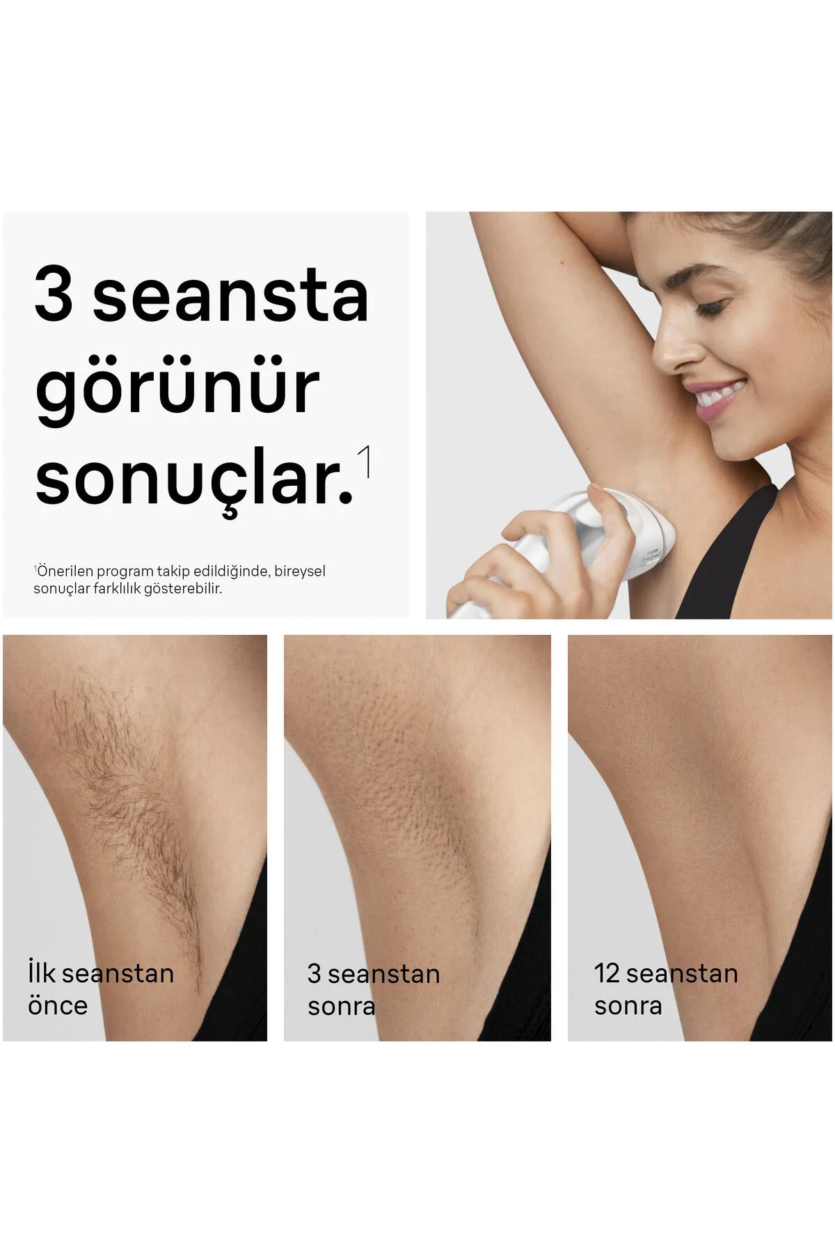 IPL Silk·expert Pro 3, Evde Lazerle Tüy Alma, Çanta, Gillette Ven