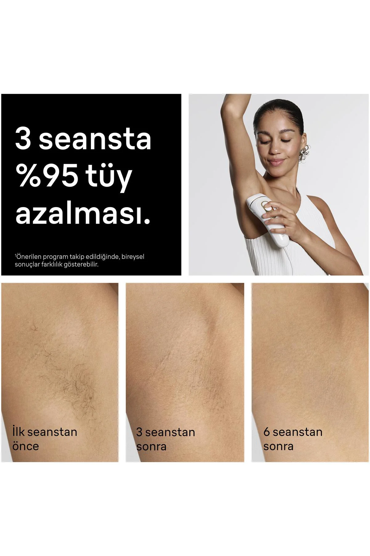 IPL Silk·expert Pro 5, Evde Lazerle Tüy Alma, Çanta, Gillette Ven