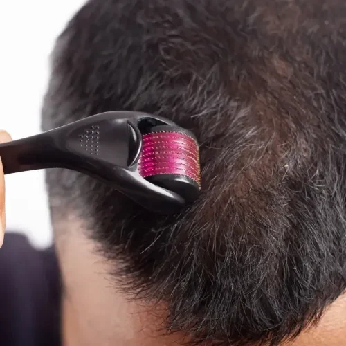 İthalat® Derma Roller Titanyum İğneli Cilt Bakım Aleti 1.00 mm