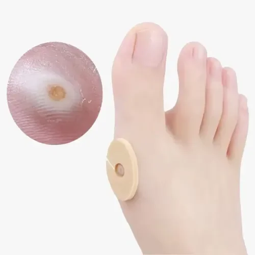 İthalat® Nasır Bandı