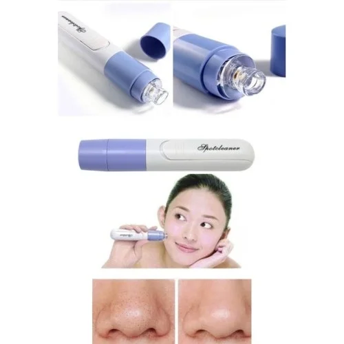 İthalat® Pore Cleaner Vakumlu Yüz Temizleme Siyah Nokta Temizleme Cihazı