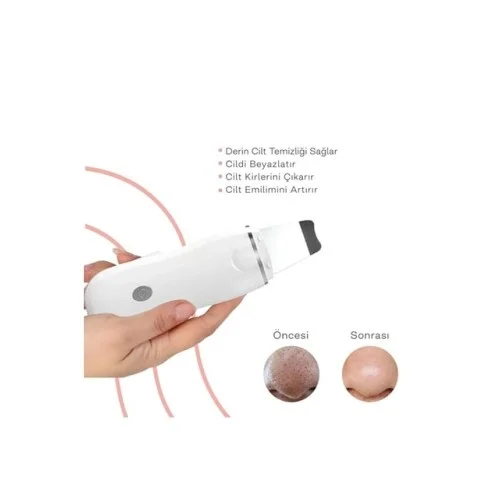 İthalat® Ultrasonik Spatula Yüz Akne Giderici Siyah Nokta Temizleme Cihazı