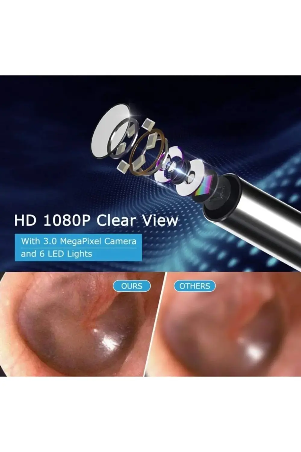 Kablosuz Hd Kameralı Kulak Temizleme Seti 360° açı 1296P Wifi Bağ