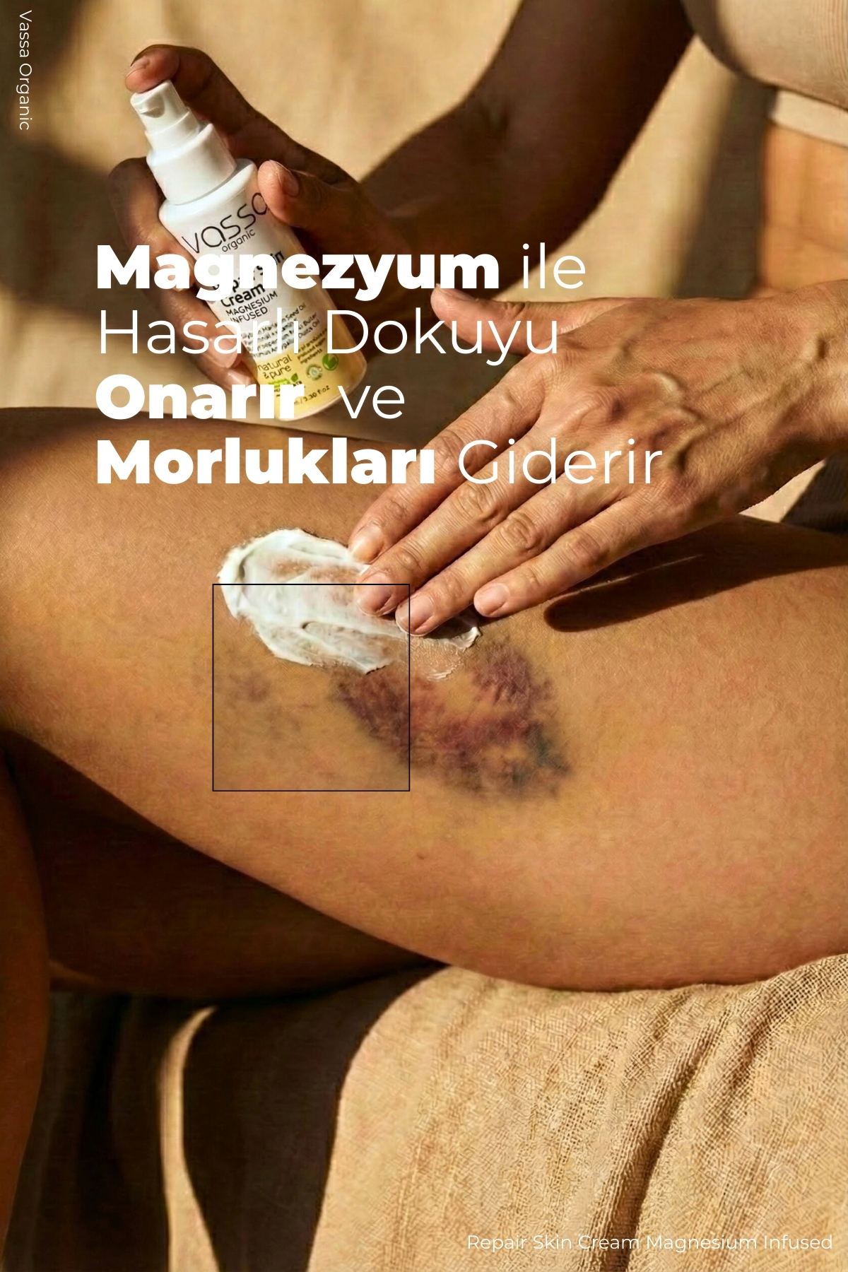 Kas ve Vücut Ağrıları İçin Rahatlatıcı, Morluk Karşıtı Bakım Kremi – Magnezyum Kremi 100 ml