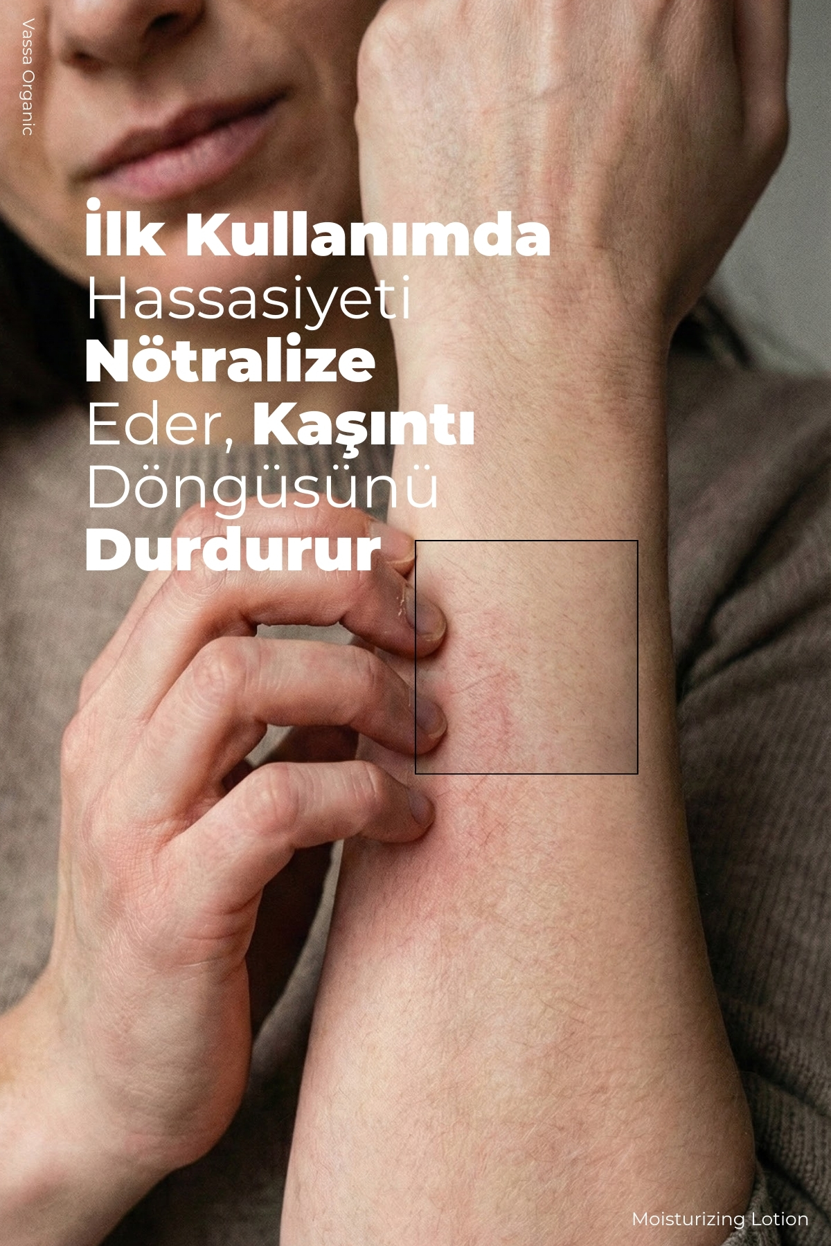 Kaşıntı Karşıtı, Pul Pul Dökülme Azaltıcı, Cilt Bakım Kremi - Yoğun Vücut Nemlendiricisi 100 ml