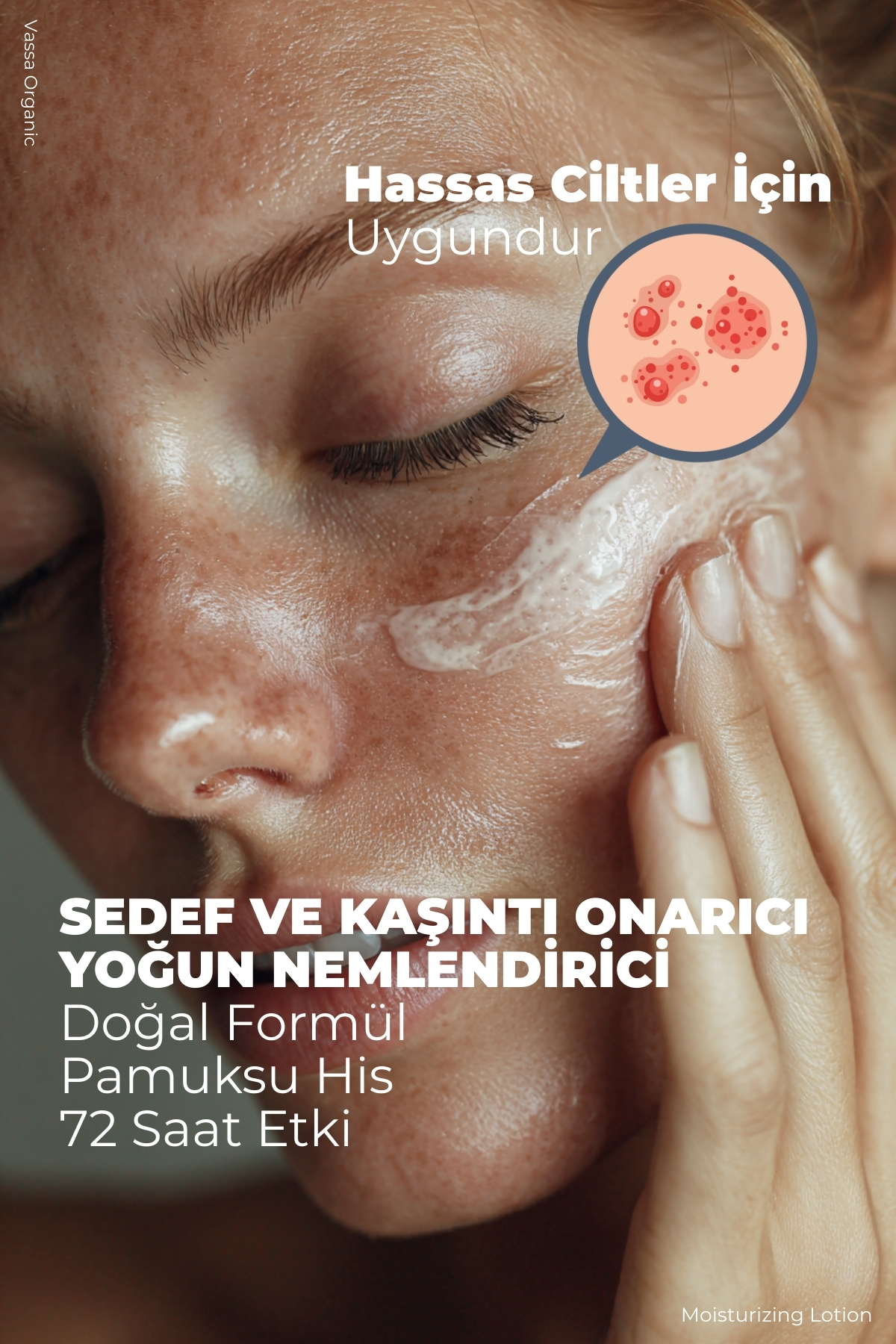 Kaşıntı Karşıtı, Pul Pul Dökülme Azaltıcı, Cilt Bakım Kremi - Yoğun Vücut Nemlendiricisi 100 ml