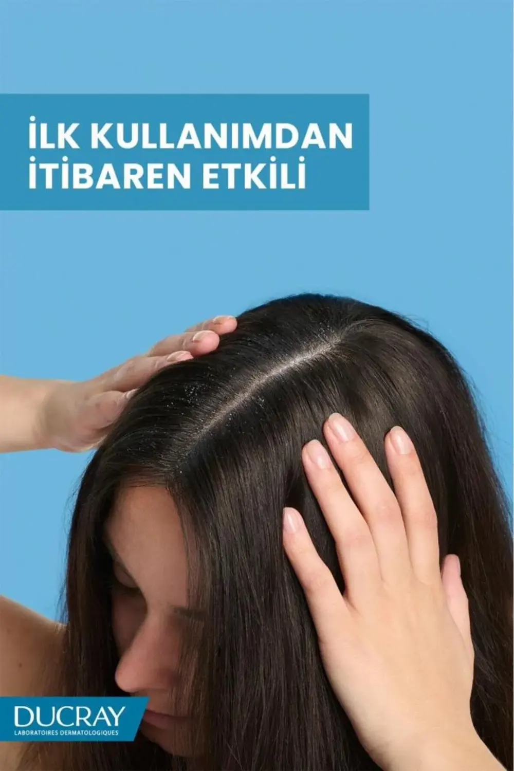 Kelual Squanorm Kuru Saçlar İçin Nemlendirici Etkili Kepek Şampua