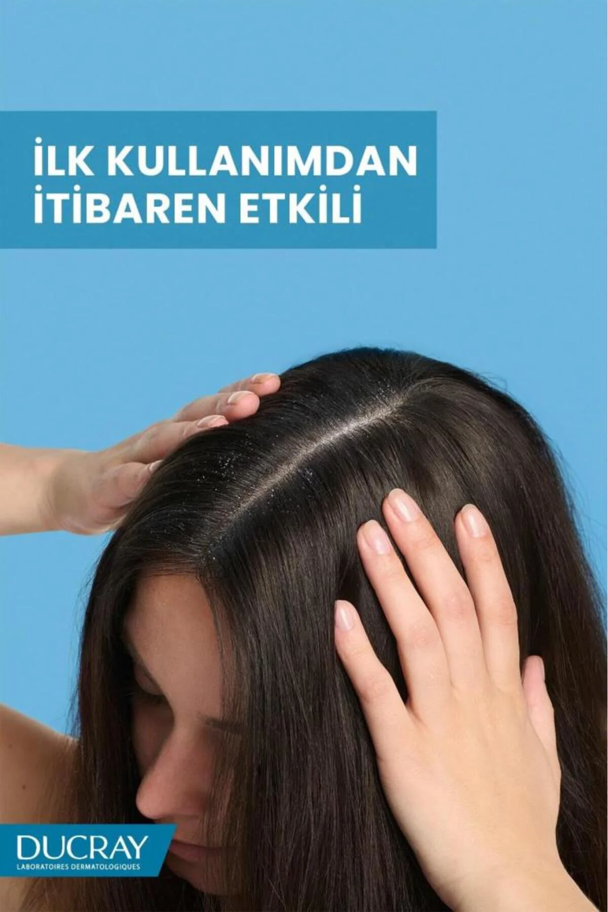 Kelual Squanorm Yağlı Saçlar için Arındırıcı Etkili Kepek Karşıtı