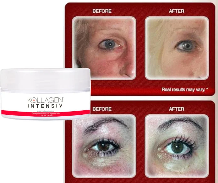 Kollagen Intensiv Krem – Zamana Meydan Okuyan Cilt Güzelliği İçin 50 ml