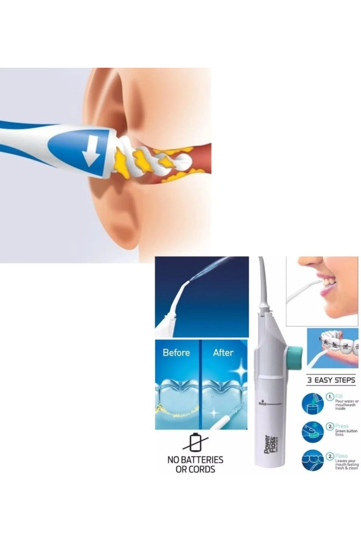 Kulak Temizleme Ve Power Floss Diş Temizleme Seti | Mekanik Ağız 