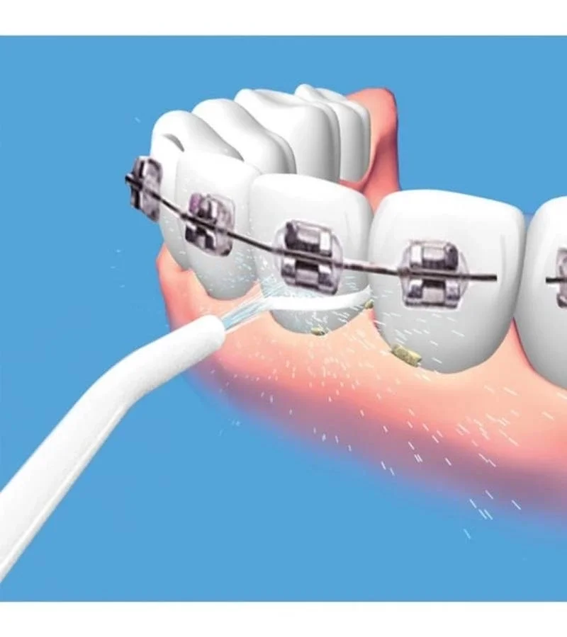 Kulak Temizleme ve Power Floss Diş Temizleme Seti | Mekanik Ağız Bakımı