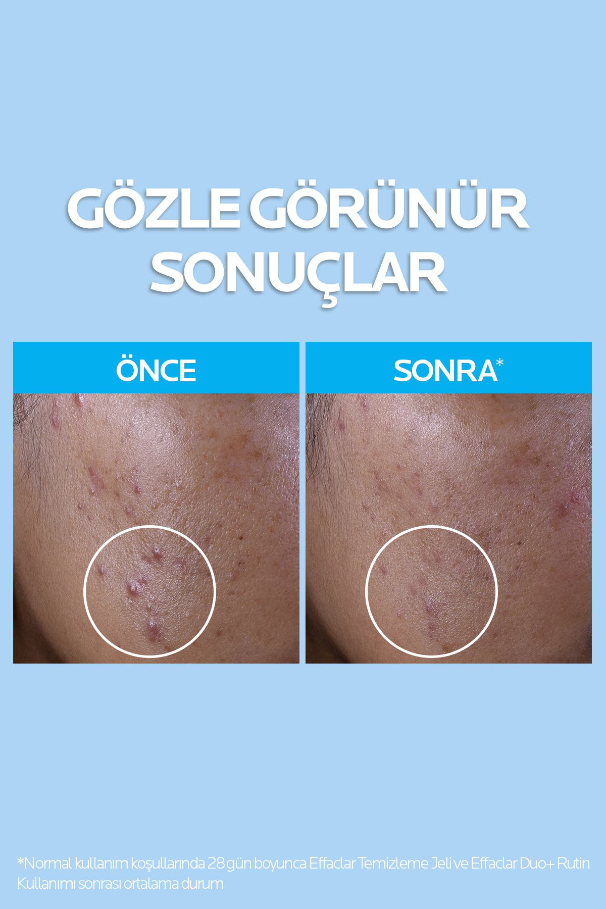 La Roche  Posay Effaclar Gel 400 Ml