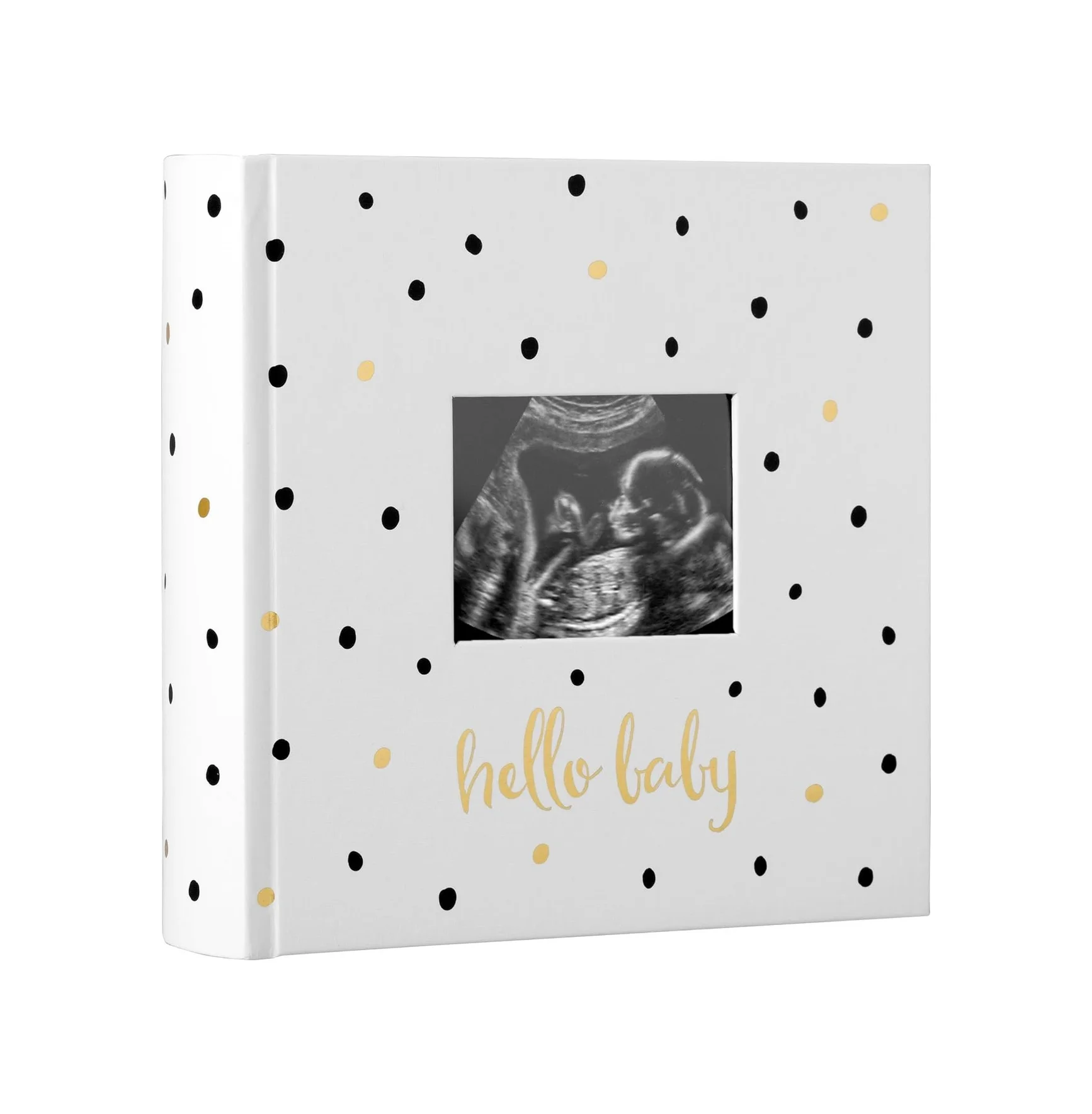 Lexroo Hello Baby Fotoğraf Albümü, Yeni Ve Bekleyen Ebeveynler İçin Bebek Kitabı Hatırası Lexroo Hello Baby Fotoğraf Albümü, Yeni Ve Bekleyen Ebeveynler İçin Bebek Kitabı Hatırası