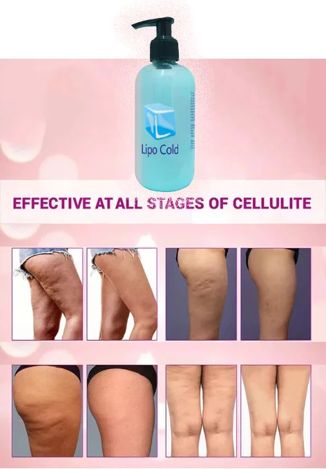 Lipo Cold Fazlalık Yağ ve Selülit Karşıtı Krem 250 ml - Vücut Şekillendirici Fiyatı, Yorumları ve Özellikleri
