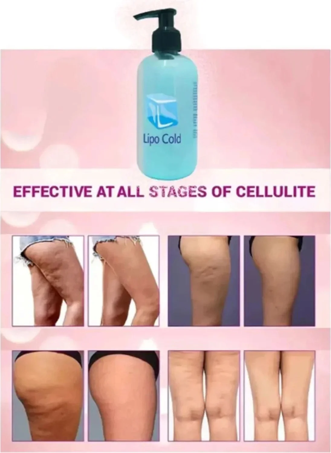 Lipo Cold Güçlü Krem 250 ml x 3 Adet - Vücut Şekillendirici