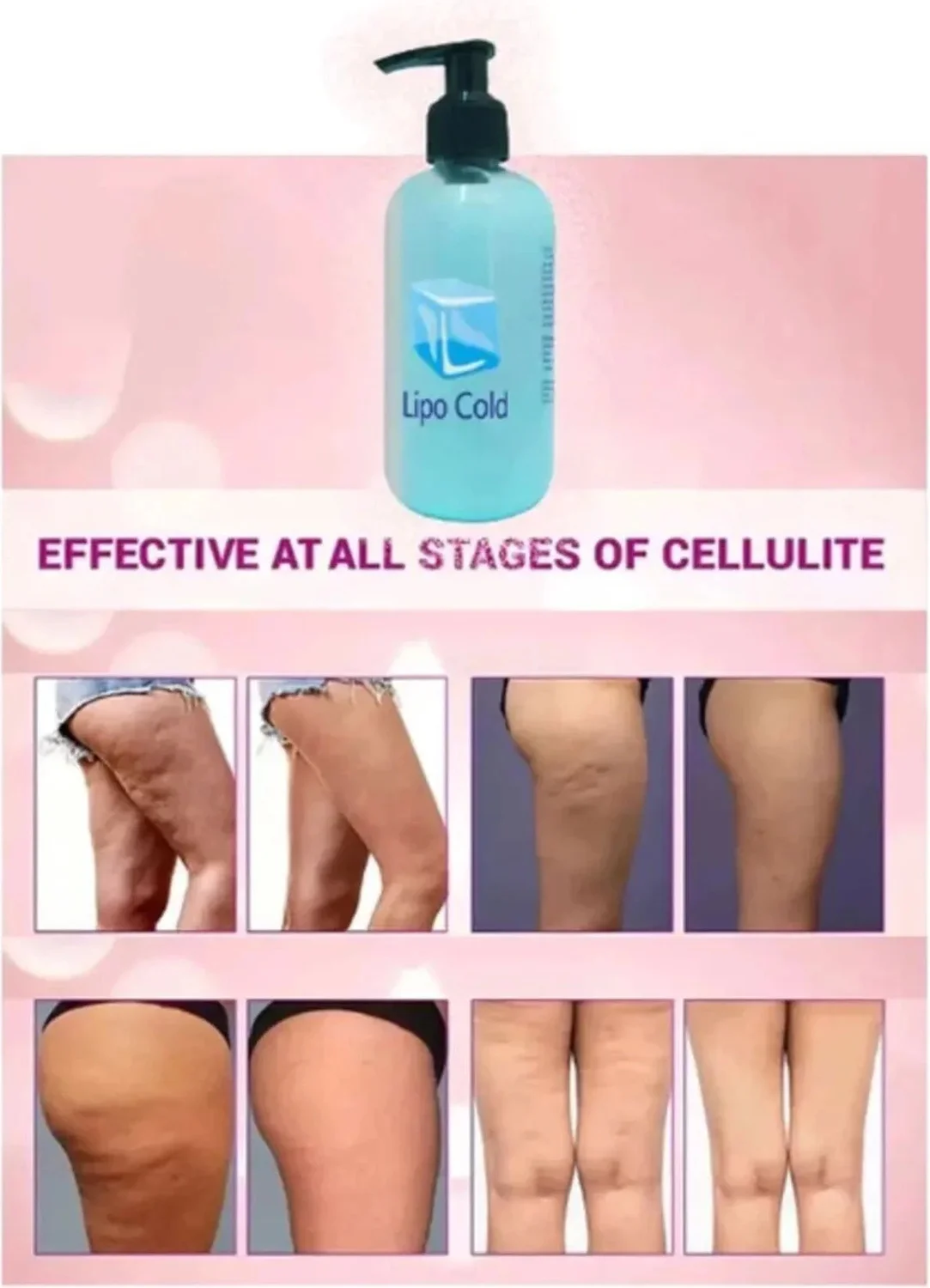 Lipo Cold Güçlü Krem 250 ml - Zayıflama ve Selülit Karşıtı Etkili Krem