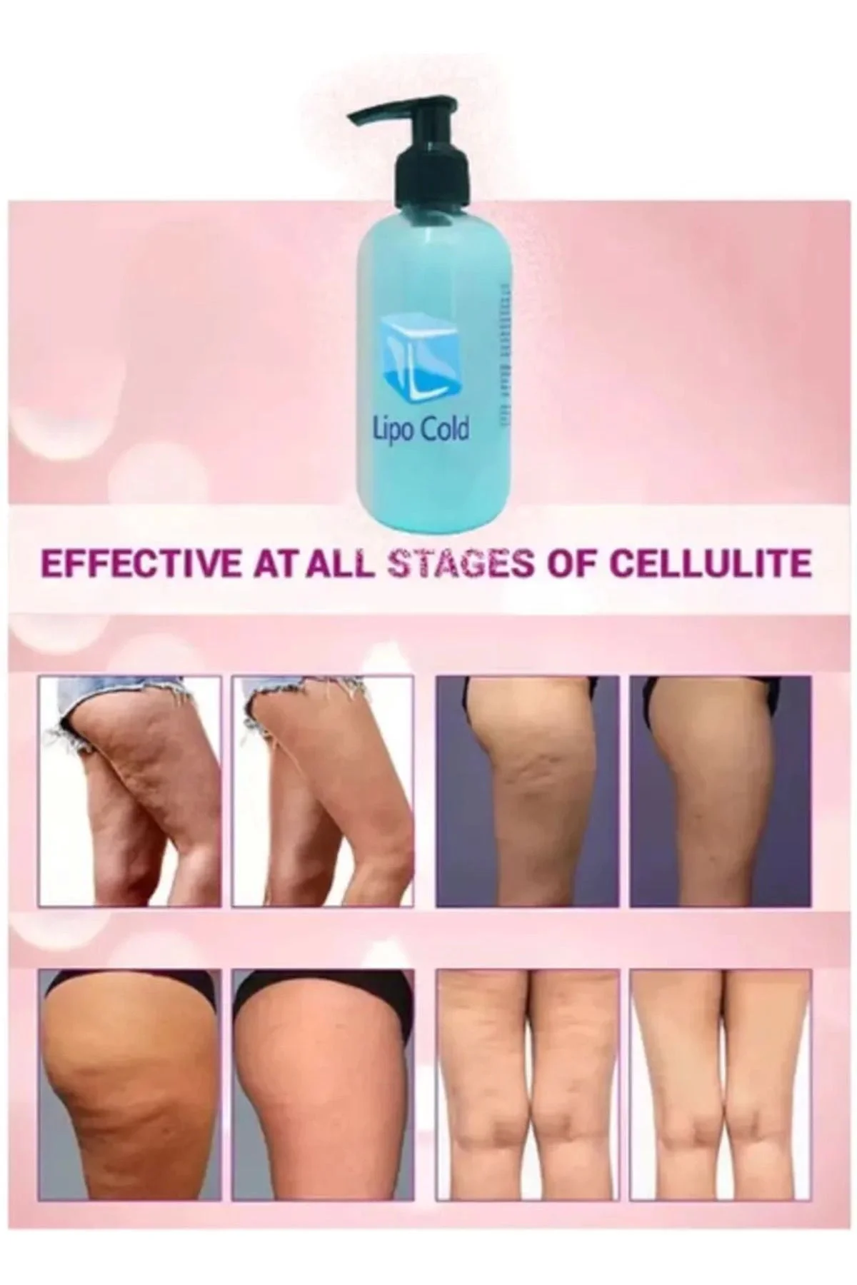 Lipo Cold Selülit Kremi - Sıkılaştırıcı & İncelten Etki 250 ml x 3 ADET