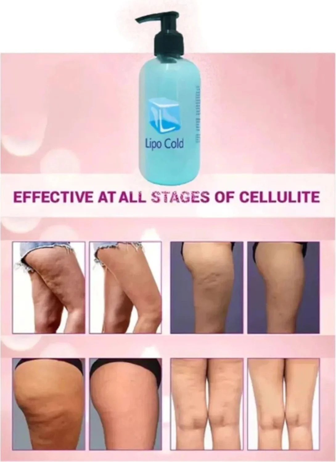 Lipo Cold Selülit Kremi 250 ml - Sıkılaştırıcı ve İncelten Etki