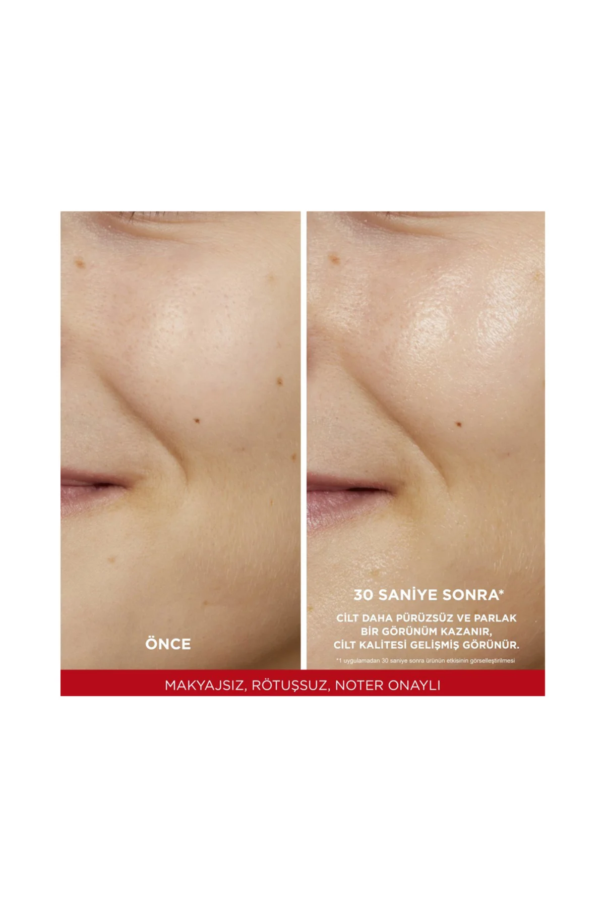 L'oréal Paris Revitalift %5 Saf Glikolik Asit Peeling Etkili Tonik 180ml