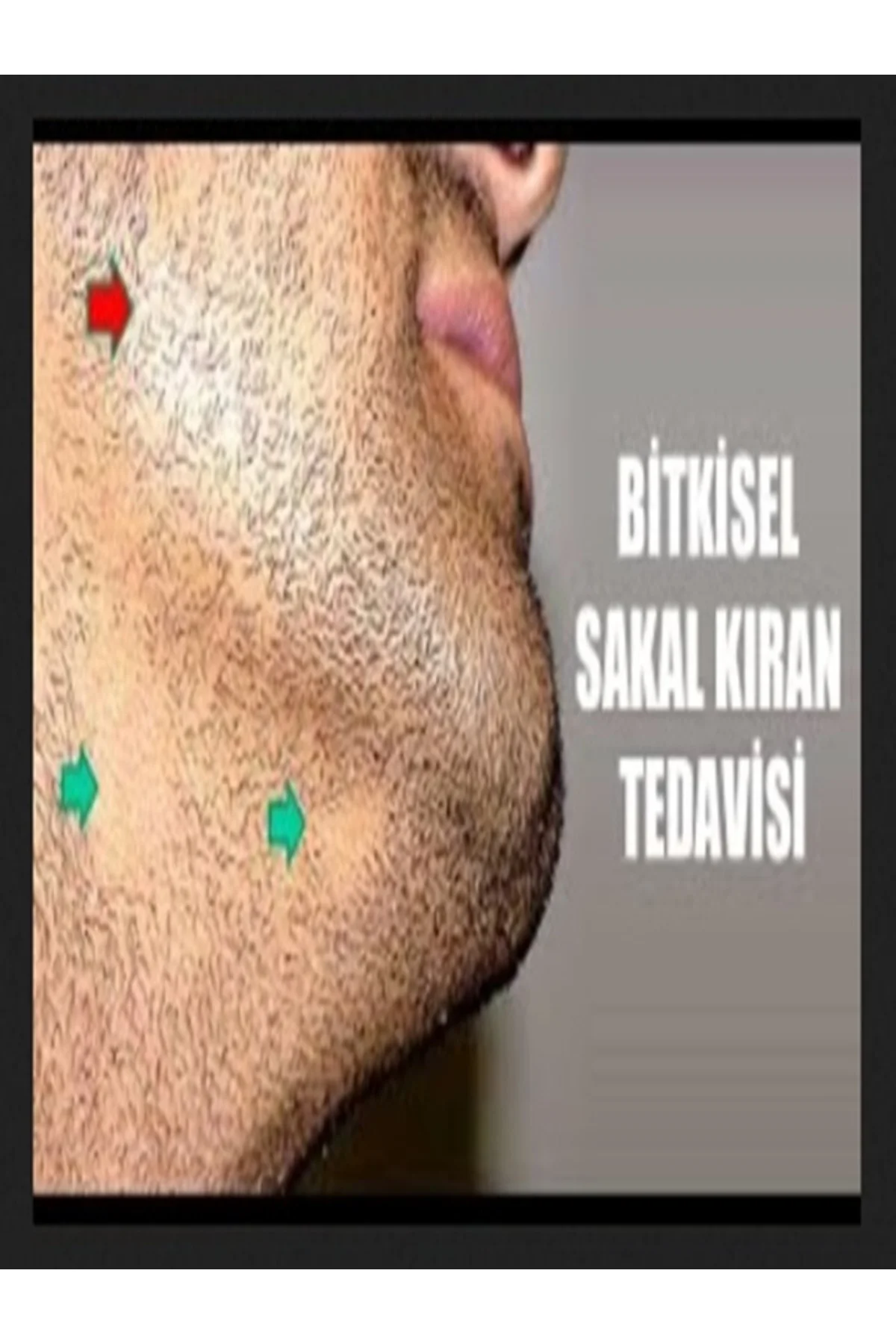 LO'RELLA Saç ve Sakal Kıran Saç Besleyici Solüsyon 20 ml