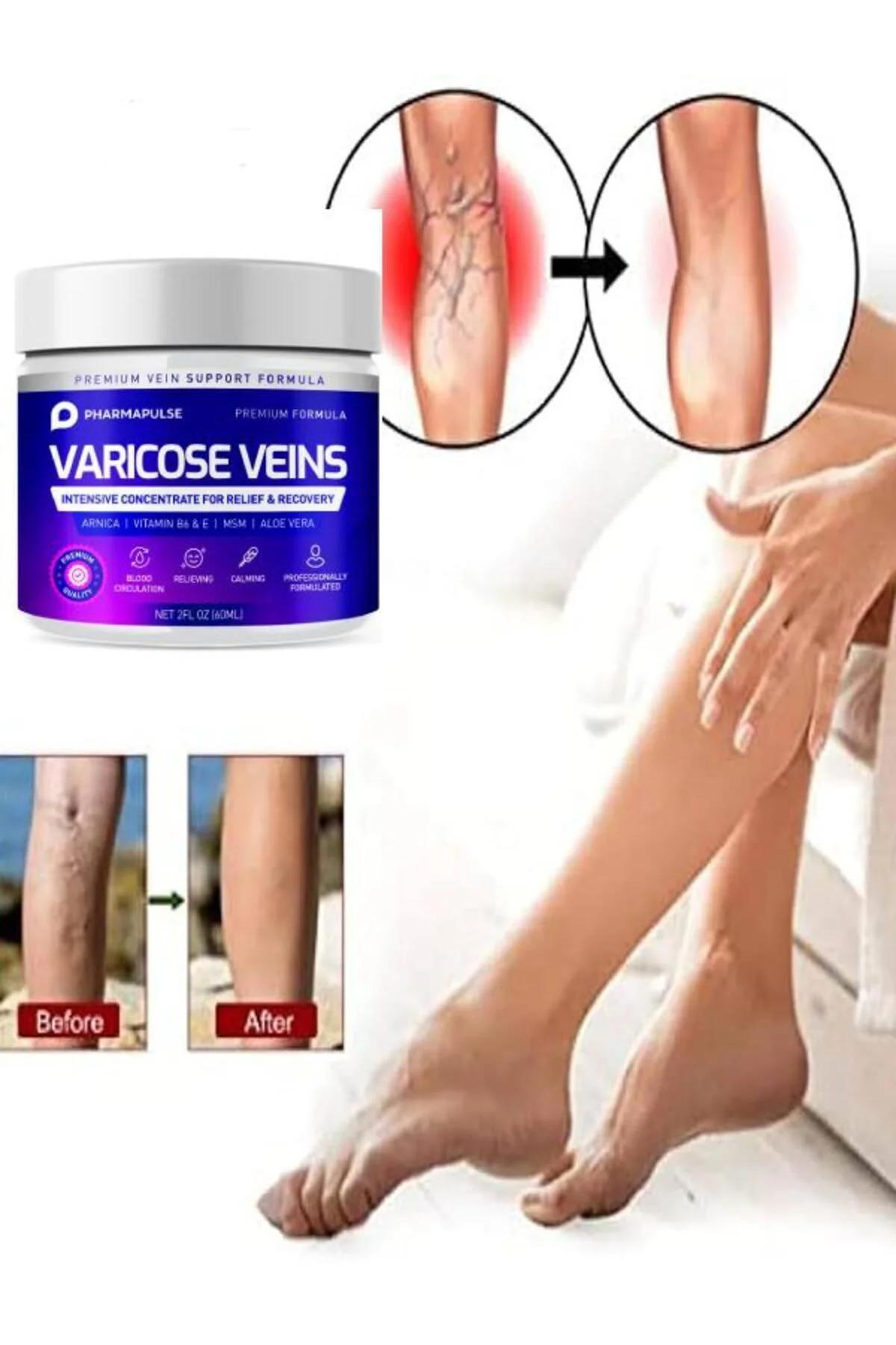 Maximum Strength Varis Bakım Masaj Kremi 100 ml – Bacak Ağrısı ve Varis İçin Etkili Çözüm Fiyatı, Yorumları ve Özellikleri