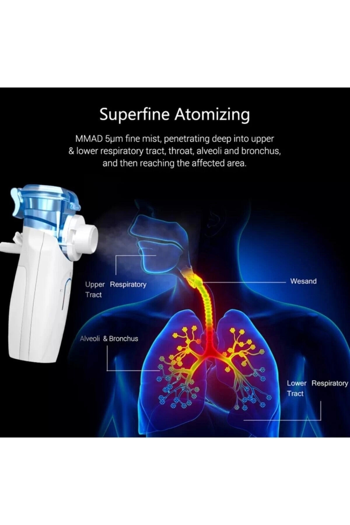 İron Medical Medıcal Ys35 Taşınabilir Mesh Nebülizatör Cihazı Şarjlı