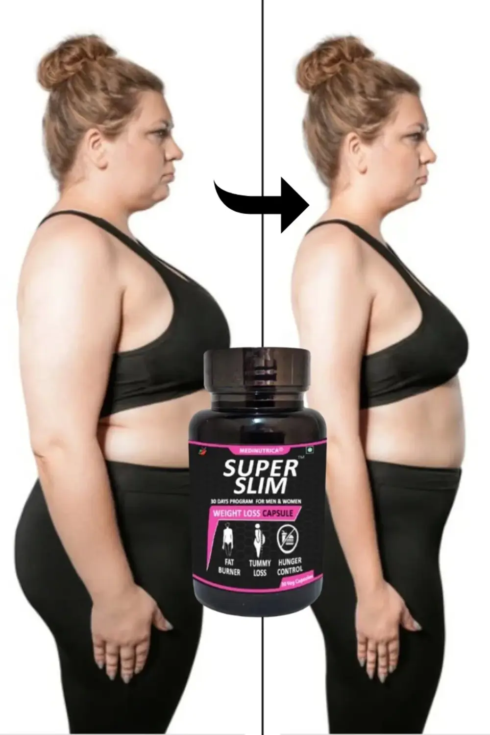 Medinutrica Super Slim Bölgesel Şekillendirici 30'lu Destekleyici