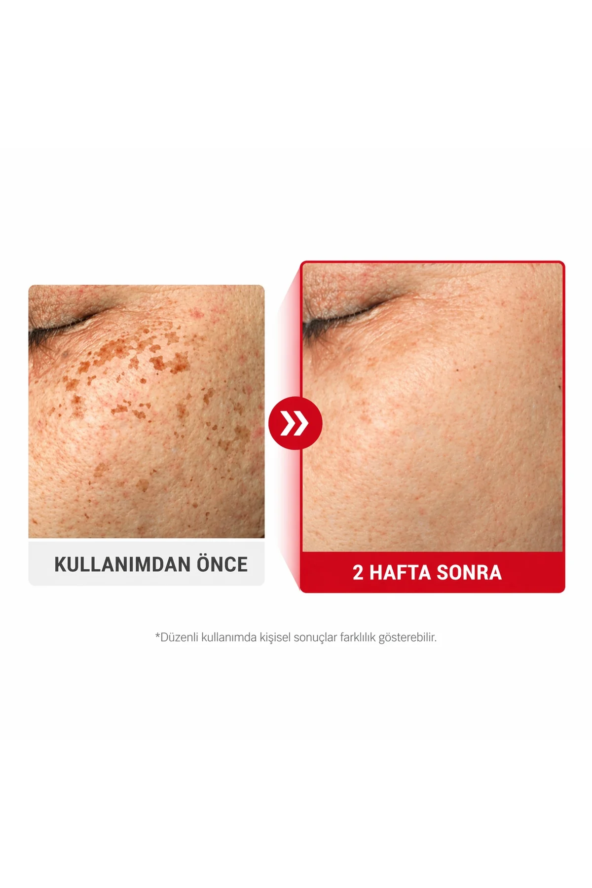 Melanon X Cream 2.0 (Leke Karşıtı Aydınlatıcı Krem