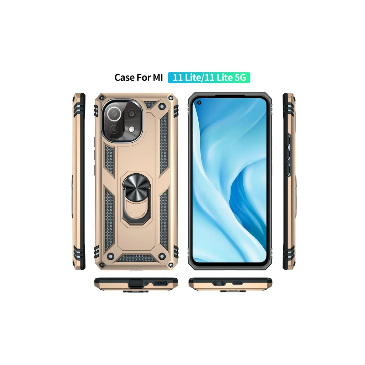 MI 11 Lite Sofia Kılıf - Ultra Koruyucu ve Şık Gold Kapak