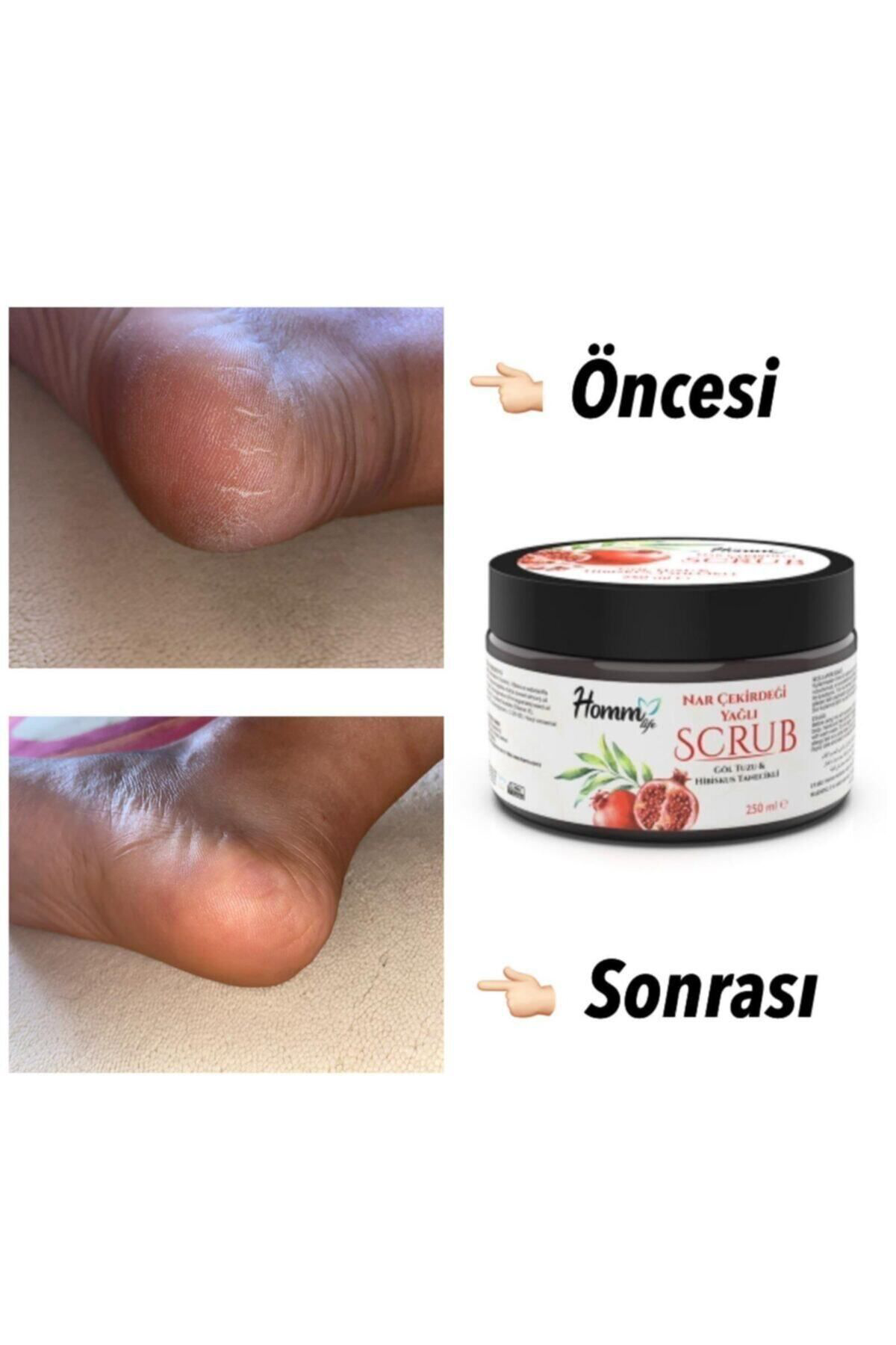 Nar Çekirdeği Yağlı Bitki Tanecikli Scrub 250 Ml-narlı Scrub