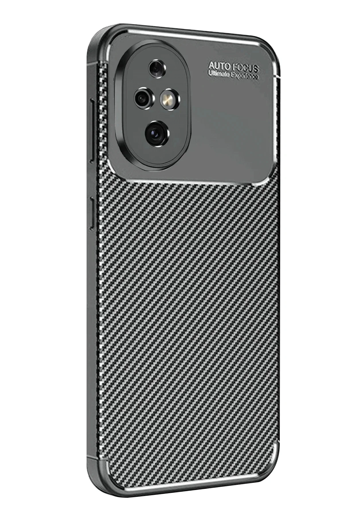 Newface Honor 200 Kılıf Auto Focus Karbon Kapak - Siyah
