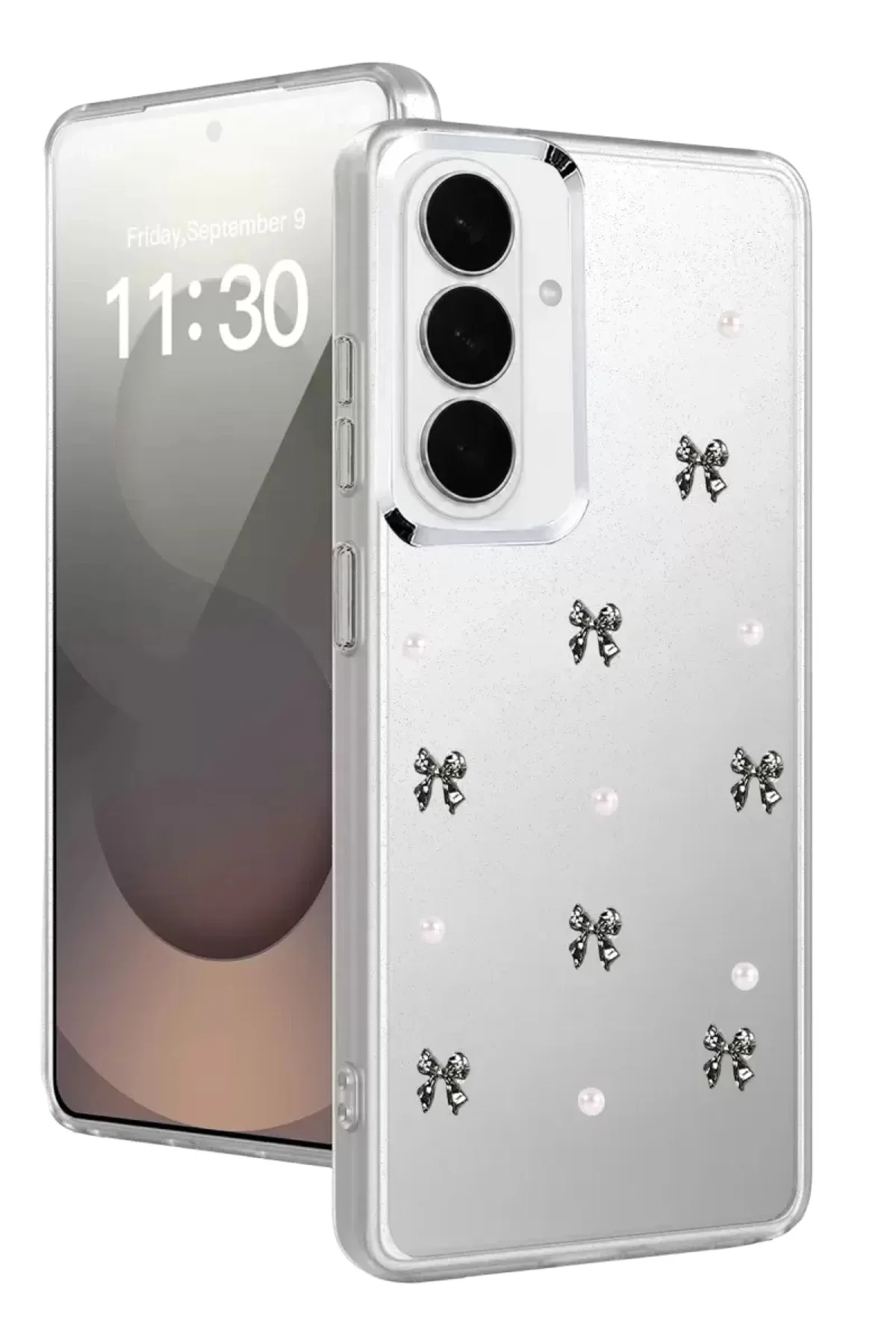 Newface Samsung Galaxy S26 Plus Fiyonk Desenli Kapak - Desen 8