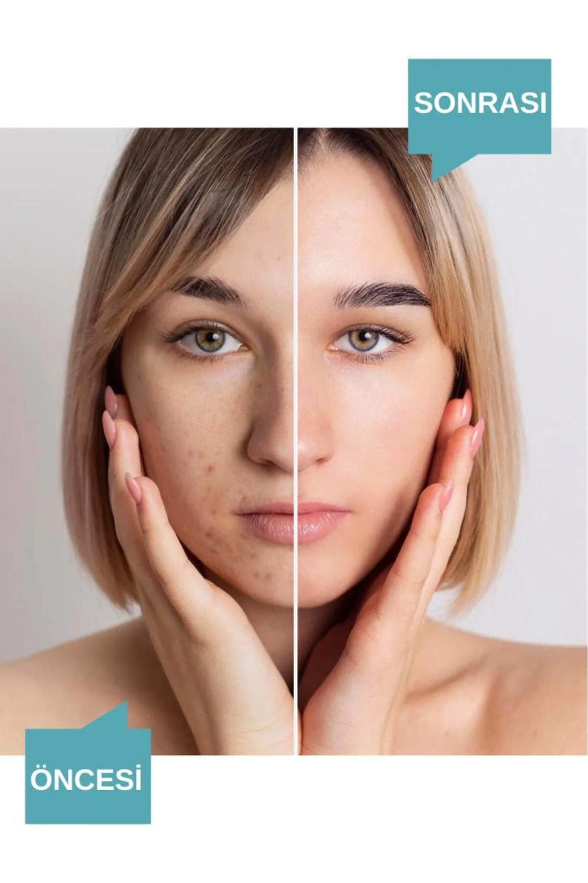 Noac Cilt Bakım Serumu 30 ml