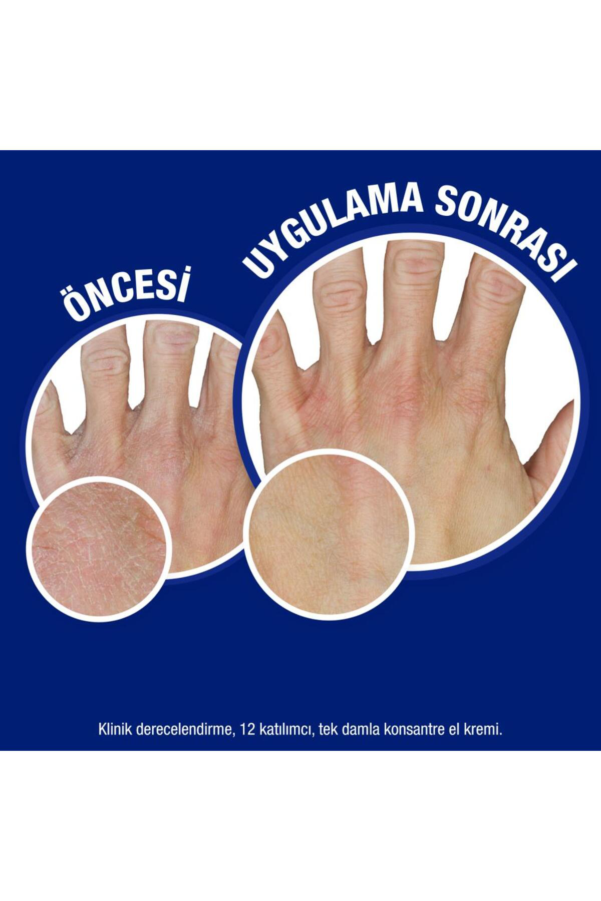 Norveç Formülü El Kremi Parfümsüz 75 Ml